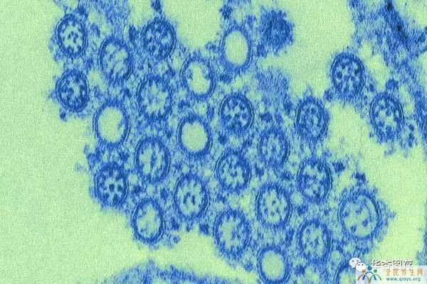 揭示真相：美国2009 H1N1流感疫情概况及抗疫事序